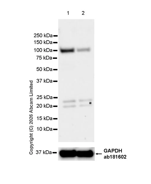 Western blot - Anti-PMS2 antibody [EPR30476-81] (AB326043)