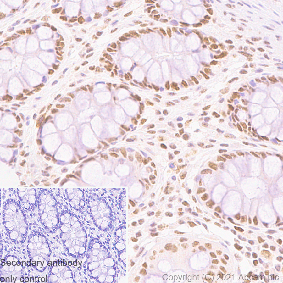 Immunohistochemistry (Formalin/PFA-fixed paraffin-embedded sections) - Anti-PMS2 antibody [EPR3947] (ab110638), expandable thumbnail