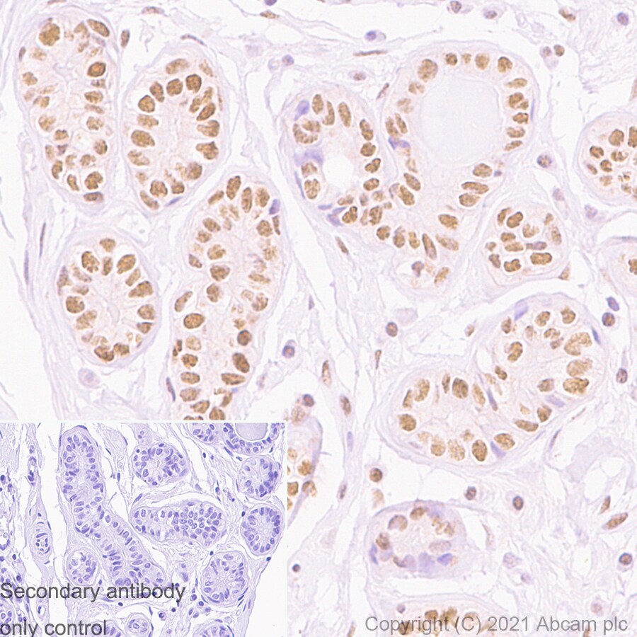 Immunohistochemistry (Formalin/PFA-fixed paraffin-embedded sections) - Anti-PMS2 antibody [EPR3947] (AB110638), expandable thumbnail