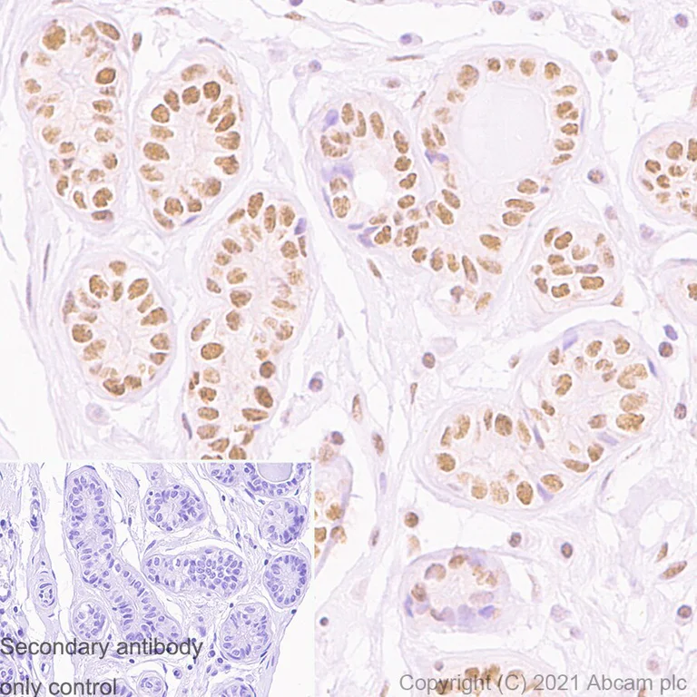 Immunohistochemistry (Formalin/PFA-fixed paraffin-embedded sections) - Anti-PMS2 antibody [EPR3947] (AB110638)