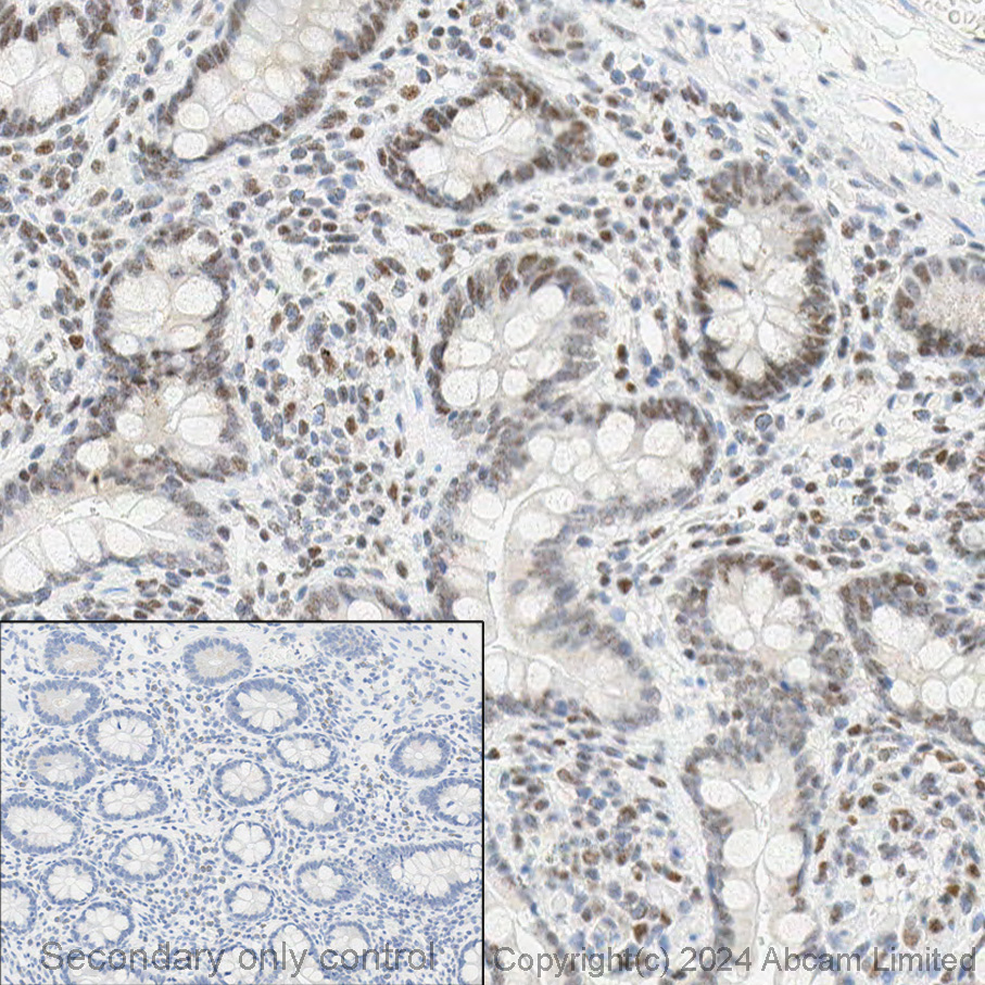 Immunohistochemistry (Formalin/PFA-fixed paraffin-embedded sections) - Anti-PMS2 antibody [EPR3947] (ab110638), expandable thumbnail
