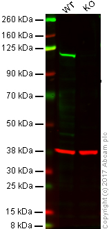 Western blot - Anti-PMS2 antibody [EPR3947] (ab110638), expandable thumbnail