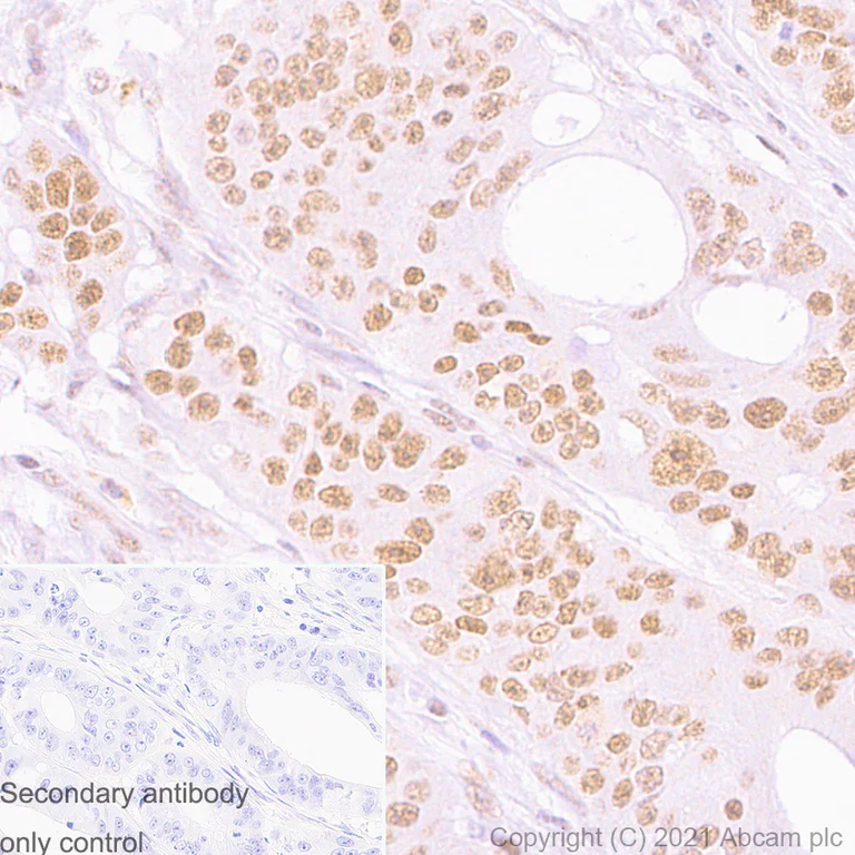 Immunohistochemistry (Formalin/PFA-fixed paraffin-embedded sections) - Anti-PMS2 antibody [EPR3947] - BSA and Azide free (AB214442)