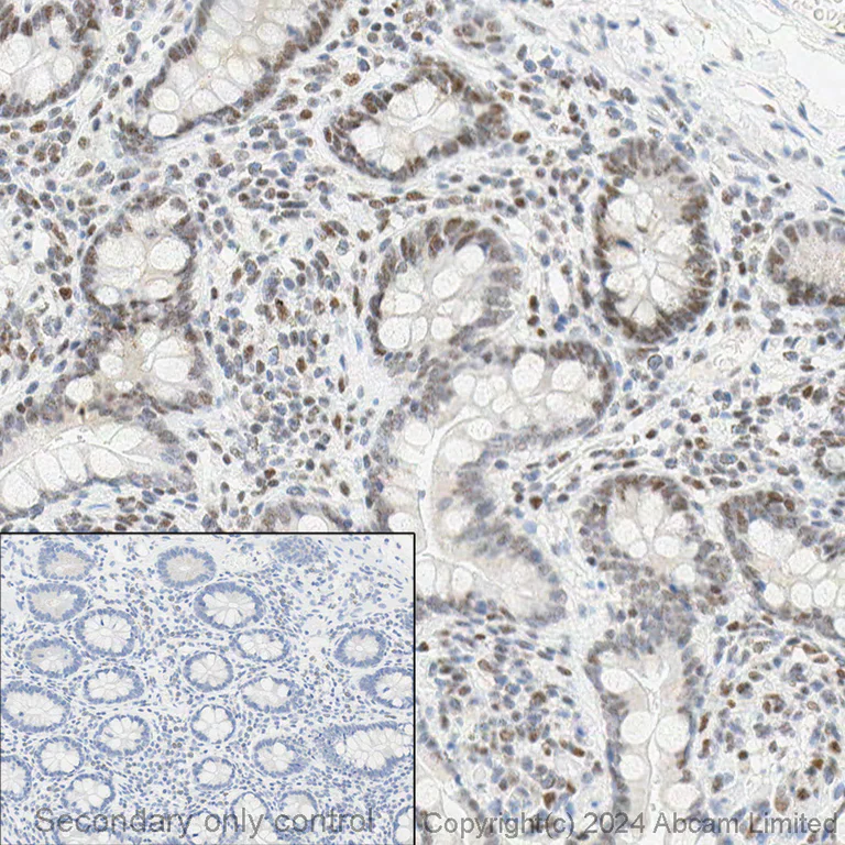 Immunohistochemistry (Formalin/PFA-fixed paraffin-embedded sections) - Anti-PMS2 antibody [EPR3947] - BSA and Azide free (AB214442)