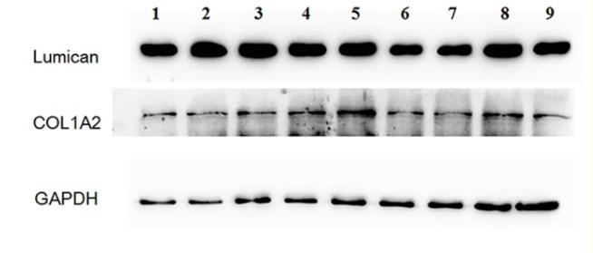 Functional Studies (Act) - PMSF, protease inhibitor (AB141032)