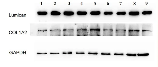 Functional Studies (Act) - PMSF, protease inhibitor (AB141032)