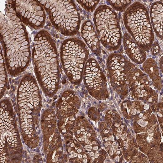 Immunohistochemistry (Formalin/PFA-fixed paraffin-embedded sections) - Anti-PN-I antibody (AB204800)