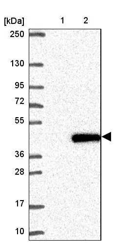 Western blot - Anti-PN-I antibody (AB204800)