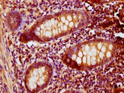 Immunohistochemistry (Formalin/PFA-fixed paraffin-embedded sections) - Anti-PNCK antibody (AB235093)