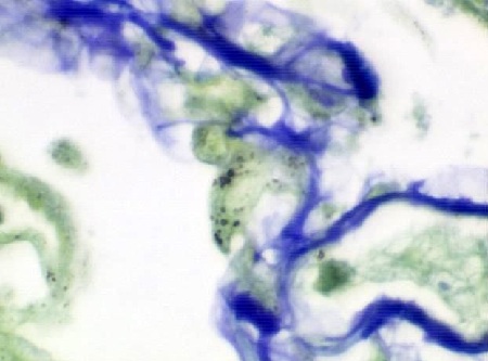 Immunohistochemistry (Formalin/PFA-fixed paraffin-embedded sections) - Pneumocystis Stain Kit (Microorganism Stain) (AB150682), expandable thumbnail
