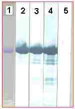Western blot - Anti-Pneumolysin antibody [PLY-4] (AB71810)