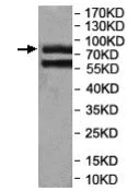Western blot - Anti-PNGase antibody (AB197107)