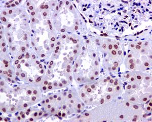 Immunohistochemistry (Formalin/PFA-fixed paraffin-embedded sections) - Anti-PNK/PNKP antibody [EPR11934(B)] (ab170954), expandable thumbnail