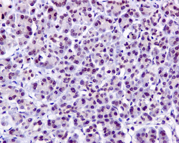 Immunohistochemistry (Formalin/PFA-fixed paraffin-embedded sections) - Anti-PNK/PNKP antibody [EPR11934(B)] (AB170954), expandable thumbnail