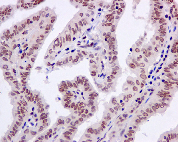 Immunohistochemistry (Formalin/PFA-fixed paraffin-embedded sections) - Anti-PNK/PNKP antibody [EPR11934(B)] (AB170954), expandable thumbnail