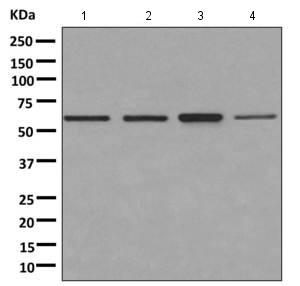 Western blot - Anti-PNK/PNKP antibody [EPR11934(B)] (AB170954), expandable thumbnail