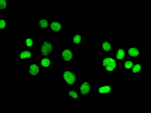 Immunocytochemistry/ Immunofluorescence - Anti-PNK/PNKP antibody [EPR11934(B)] - BSA and Azide free (AB249619)