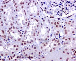 Immunohistochemistry (Formalin/PFA-fixed paraffin-embedded sections) - Anti-PNK/PNKP antibody [EPR11934(B)] - BSA and Azide free (AB249619)