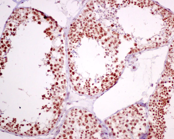 Immunohistochemistry (Formalin/PFA-fixed paraffin-embedded sections) - Anti-PNK/PNKP antibody [EPR11934(B)] - BSA and Azide free (AB249619)