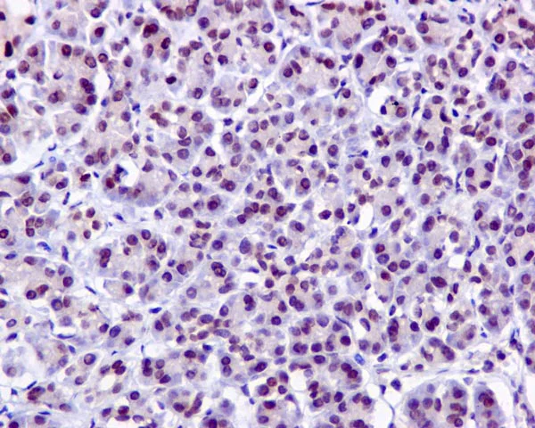 Immunohistochemistry (Formalin/PFA-fixed paraffin-embedded sections) - Anti-PNK/PNKP antibody [EPR11934(B)] - BSA and Azide free (AB249619)