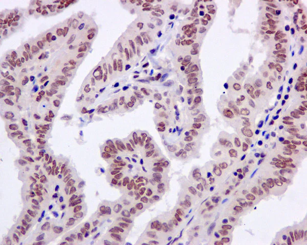Immunohistochemistry (Formalin/PFA-fixed paraffin-embedded sections) - Anti-PNK/PNKP antibody [EPR11934(B)] - BSA and Azide free (AB249619)
