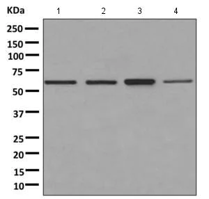 Western blot - Anti-PNK/PNKP antibody [EPR11934(B)] - BSA and Azide free (AB249619)
