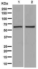 Western blot - Anti-PNK/PNKP antibody [EPR11935] - BSA and Azide free (AB250354)