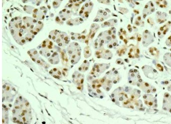 Immunohistochemistry (Formalin/PFA-fixed paraffin-embedded sections) - Anti-PNK/PNKP antibody [EPR11935] - C-terminal (AB181107), expandable thumbnail