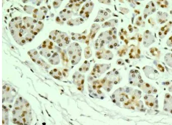 Immunohistochemistry (Formalin/PFA-fixed paraffin-embedded sections) - Anti-PNK/PNKP antibody [EPR11935] - C-terminal (AB181107)