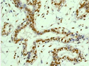 Immunohistochemistry (Formalin/PFA-fixed paraffin-embedded sections) - Anti-PNK/PNKP antibody [EPR11935] - C-terminal (AB181107), expandable thumbnail