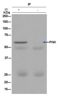 Immunoprecipitation - Anti-PNK/PNKP antibody [EPR11935] - C-terminal (AB181107), expandable thumbnail