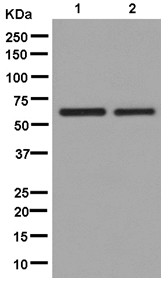 Western blot - Anti-PNK/PNKP antibody [EPR11935] - C-terminal (AB181107), expandable thumbnail