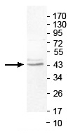 Western blot - Anti-PNKD antibody (AB140115)