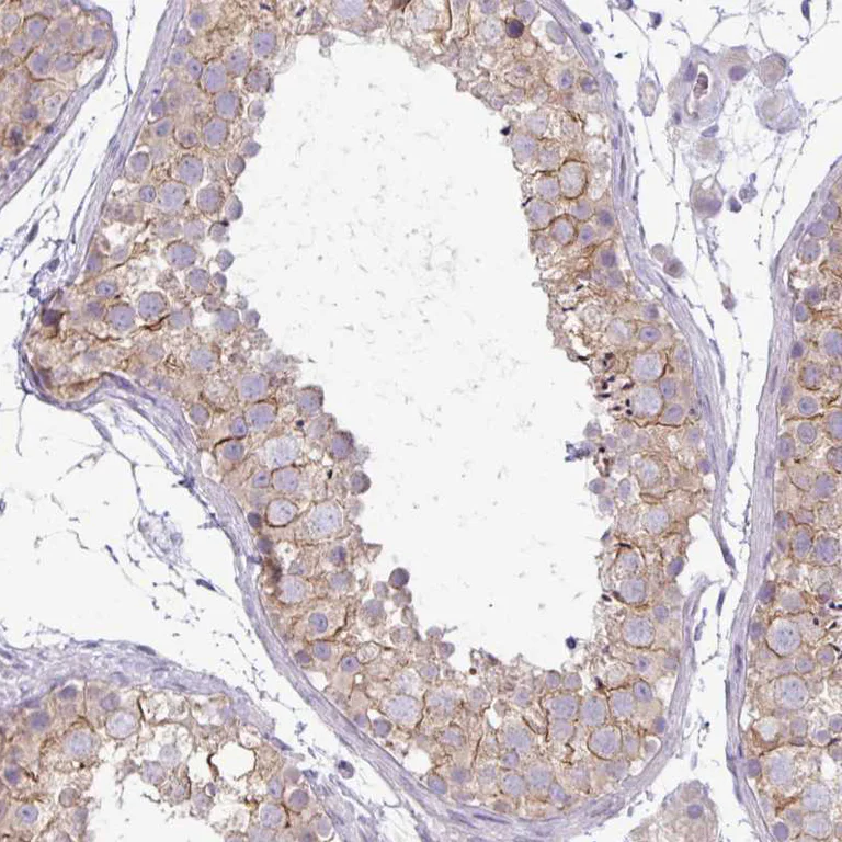 Immunohistochemistry (Formalin/PFA-fixed paraffin-embedded sections) - Anti-PNLDC1 antibody (AB151151)