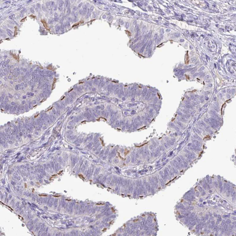 Immunohistochemistry (Formalin/PFA-fixed paraffin-embedded sections) - Anti-PNLDC1 antibody (AB151151)
