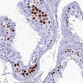 Immunohistochemistry (Formalin/PFA-fixed paraffin-embedded sections) - Anti-PNMA5 antibody (AB150921)