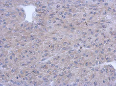 Immunohistochemistry (Formalin/PFA-fixed paraffin-embedded sections) - Anti-PNMT antibody (AB154282)