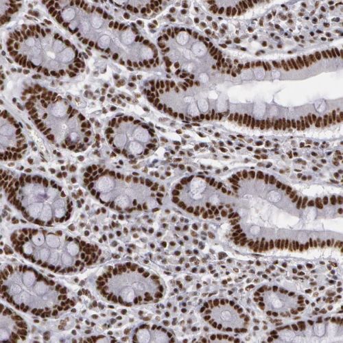 Immunohistochemistry (Formalin/PFA-fixed paraffin-embedded sections) - Anti-PNN/DRSP antibody (AB244250)