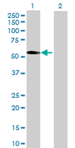 Western blot - Anti-PNPLA3 antibody (AB69170), expandable thumbnail