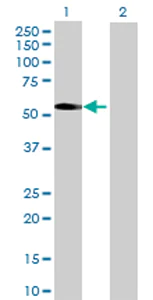 Western blot - Anti-PNPLA3 antibody (AB69170)