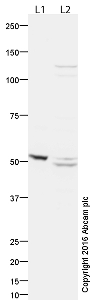 Western blot - Anti-PNPLA3 antibody (AB81874)