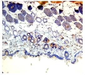 Immunohistochemistry (Formalin/PFA-fixed paraffin-embedded sections) - Anti-PNPLA3 antibody (AB87875)