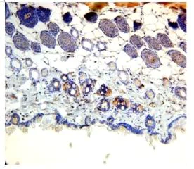Immunohistochemistry (Formalin/PFA-fixed paraffin-embedded sections) - Anti-PNPLA3 antibody (AB87875)
