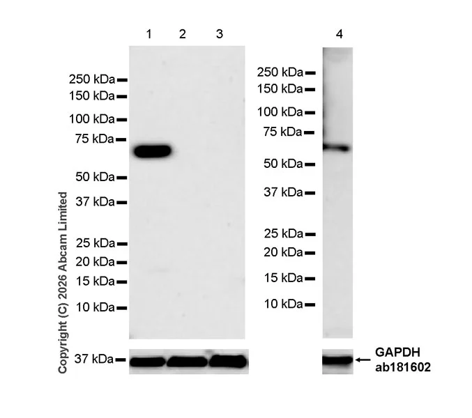 Western blot - Anti-PNPLA3 antibody [EPR29816-94] - BSA and Azide free (AB326093)