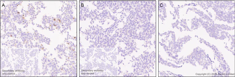 Immunohistochemistry (Formalin/PFA-fixed paraffin-embedded sections) - Anti-PNPLA3 I148M variant antibody [EPR30478-510] (AB325019)