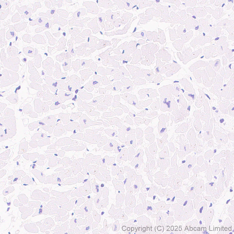 Immunohistochemistry (Formalin/PFA-fixed paraffin-embedded sections) - Anti-PNPLA3 I148M variant antibody [EPR30478-510] (AB325019)