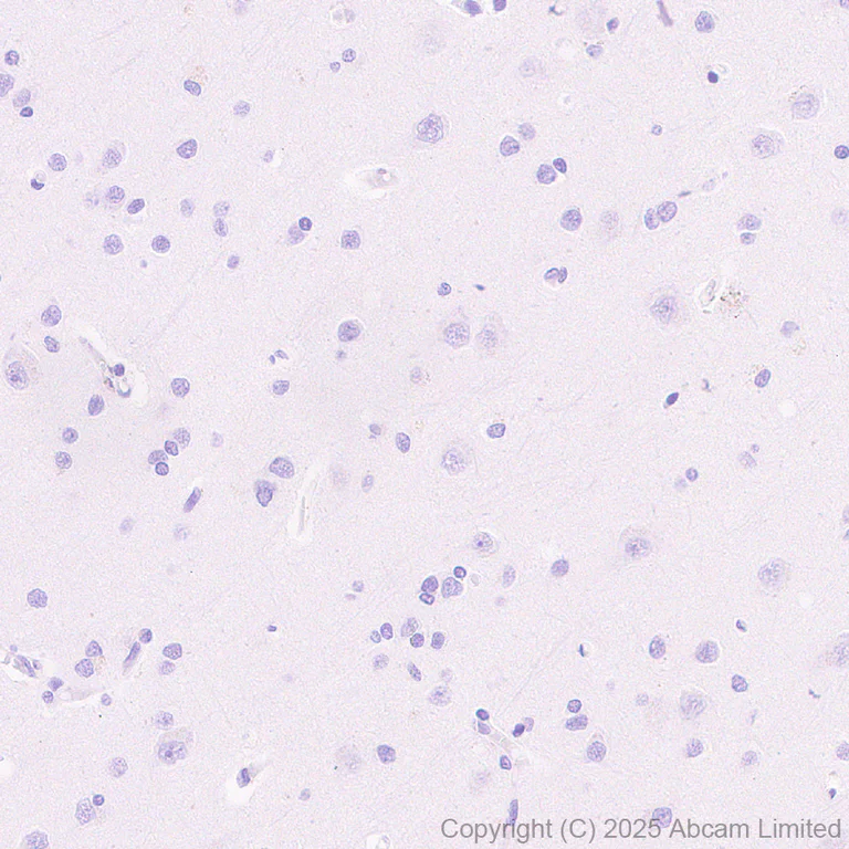 Immunohistochemistry (Formalin/PFA-fixed paraffin-embedded sections) - Anti-PNPLA3 I148M variant antibody [EPR30478-510] - BSA and Azide free (AB325023)