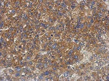 Immunohistochemistry (Formalin/PFA-fixed paraffin-embedded sections) - Anti-PNPLA4 antibody (AB125879)