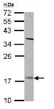 Western blot - Anti-PNPLA4 antibody (AB125879)