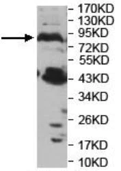 Western blot - Anti-PNPLA8 antibody (AB140151)